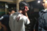 Foto: Keponakan penjual durian yang di bacok 